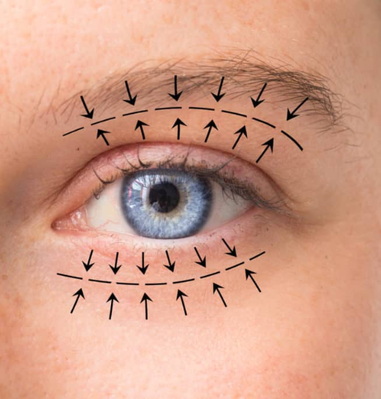 Orbit Oculoplastic and Lacrimal Surgery