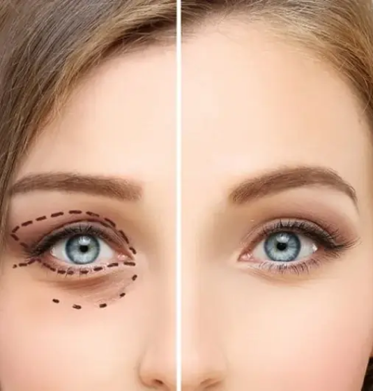 Orbit and Oculoplastic Surgery