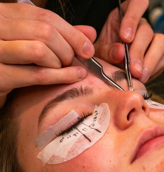 Dry Eye Symptoms